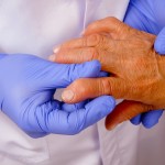 Senior woman with Rheumatoid arthritis visit a doctor