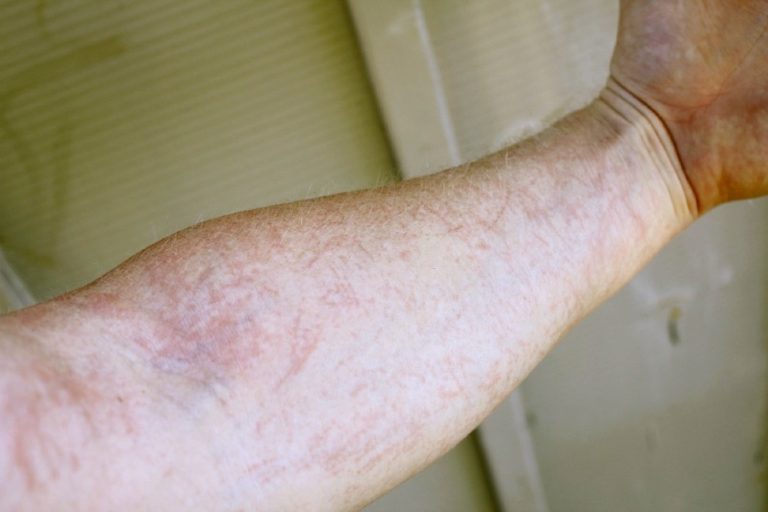 Pest Patrol Dealing with cleavers in winter wheat crops