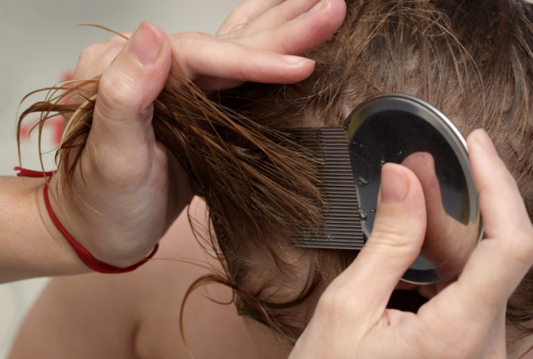 Guide Health The itchiness of head lice Country Guide