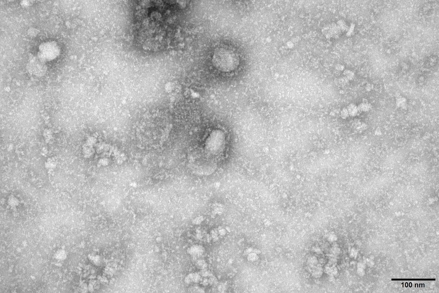 A transmission electron microscopy image of the first isolated case of the new 2019 coronavirus, as obtained by Reuters on Jan. 27, 2020. (Handout image courtesy IVDC, China CDC via Reuters)
