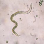 File photo of a roundworm larva. (Dotana/iStock/Getty Images)