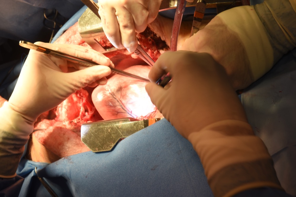 A view of the pig heart used in the transplant, before its removal from the pig, on Jan. 7, 2022. (Medschool.umaryland.edu)
