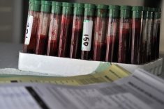 This file photo shows a rack of blood samples being tested for bovine tuberculosis in New Zealand dairy cattle. (Lakeview_Images/iStock/Getty Images)